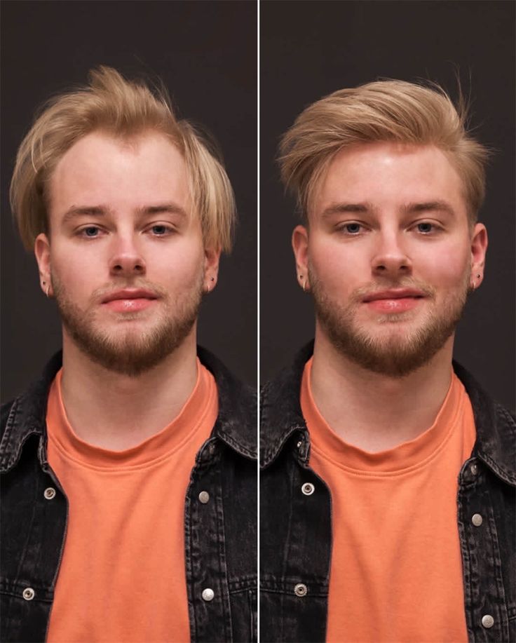 Hair Bonding in Bhopal